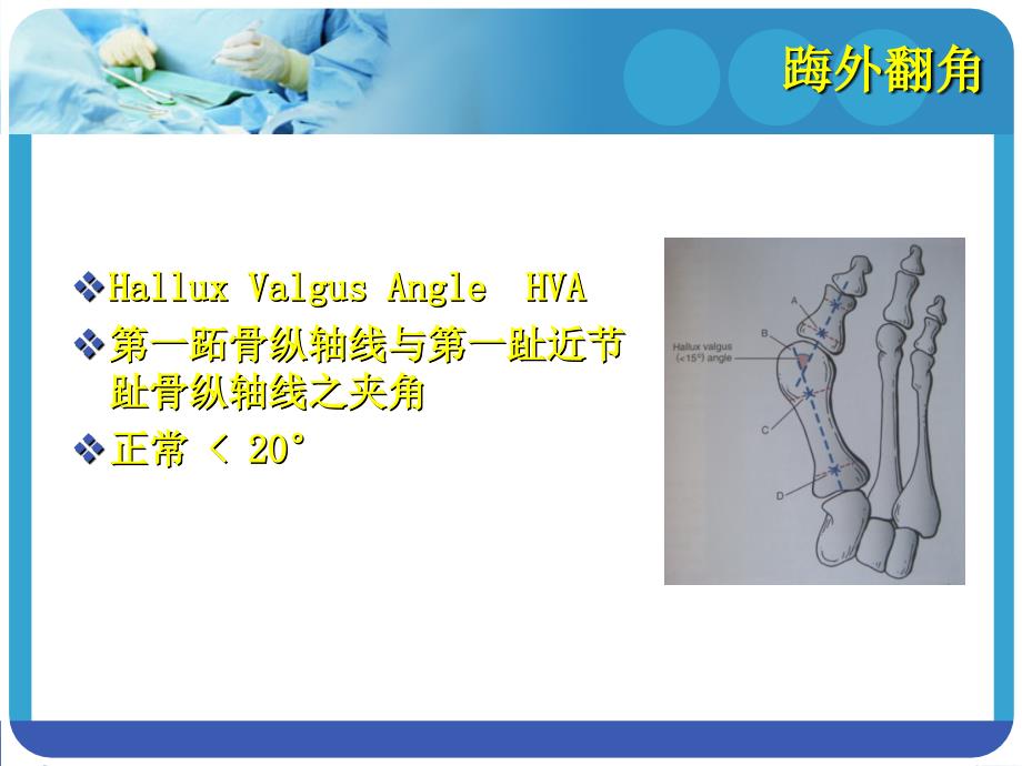 改良CHEVRON手术和AKIN手术_第3页