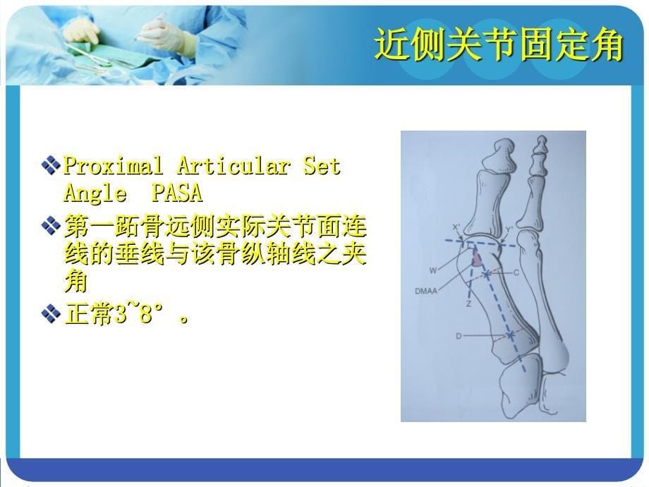 改良CHEVRON手术和AKIN手术_第5页