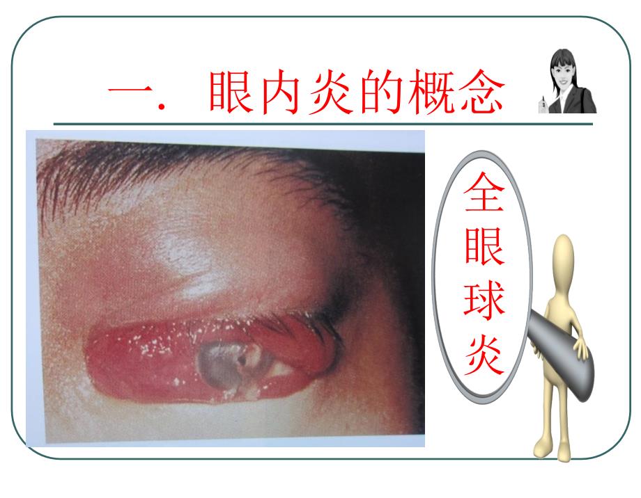 眼内炎的急救与护理_第4页