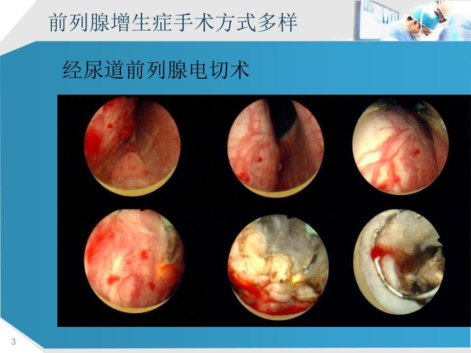 前列腺余例体会_第3页