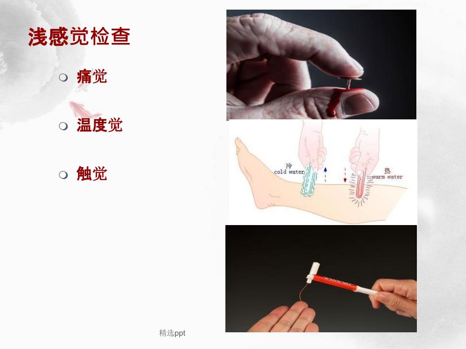 感觉功能检查_第4页