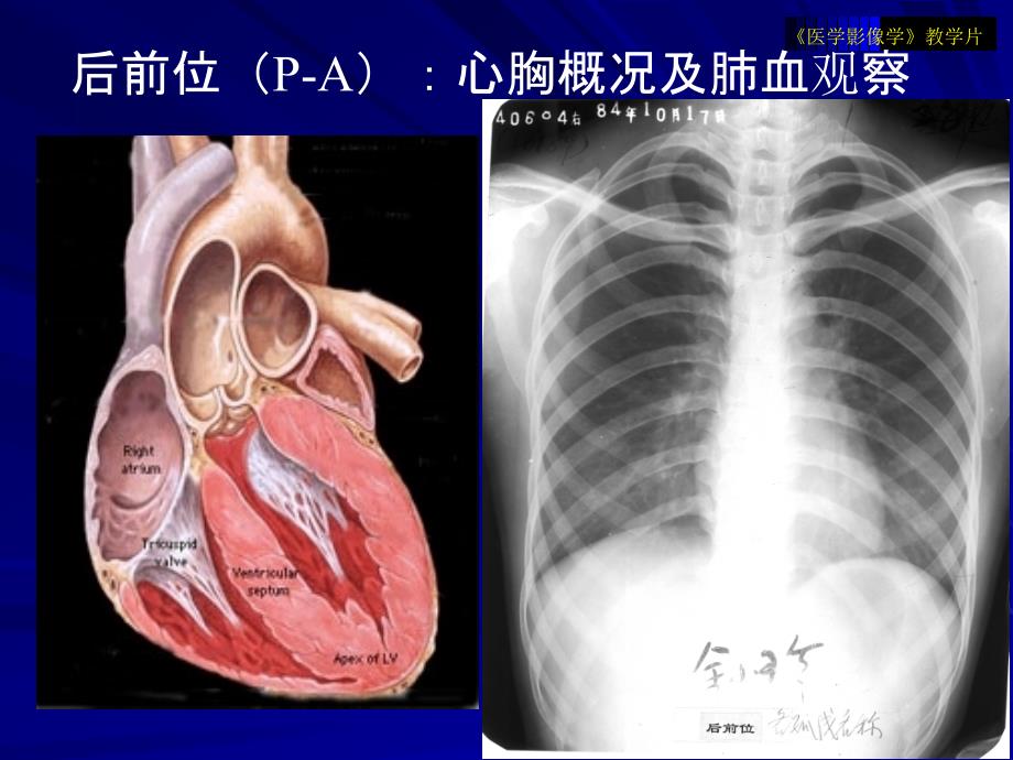 医学影像学教学片循环1_第3页