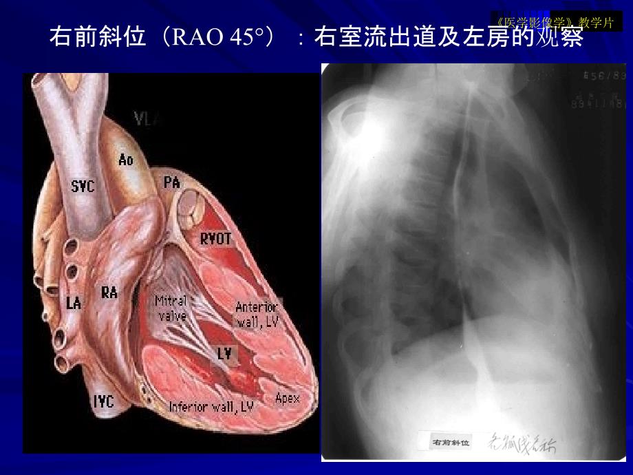 医学影像学教学片循环1_第4页