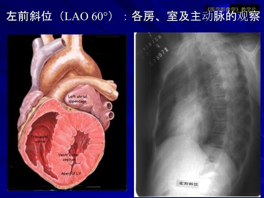 医学影像学教学片循环1_第5页