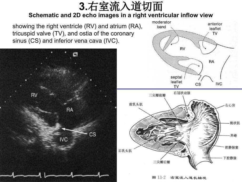 二维超声心动图常用切面及选择_第5页