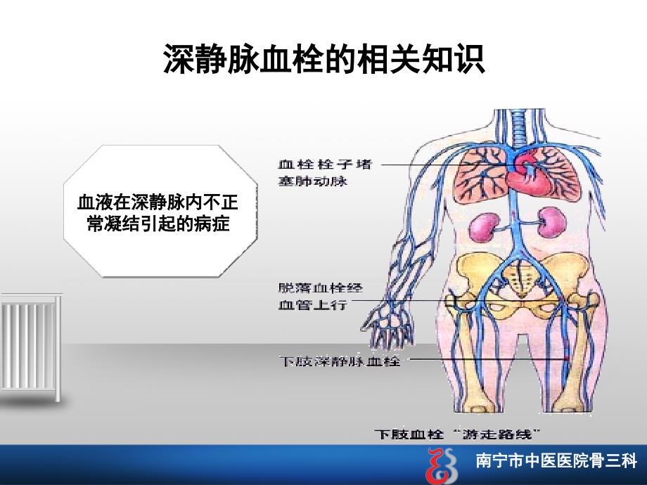 深静脉血栓的护理查房_第2页