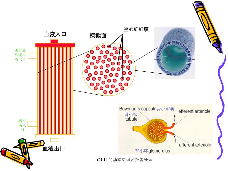 CRRT的基本原理及报警处理课件_第4页