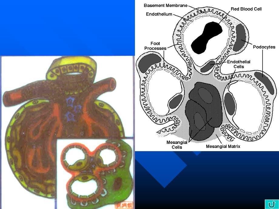 医学泌尿生殖系统病理_第5页