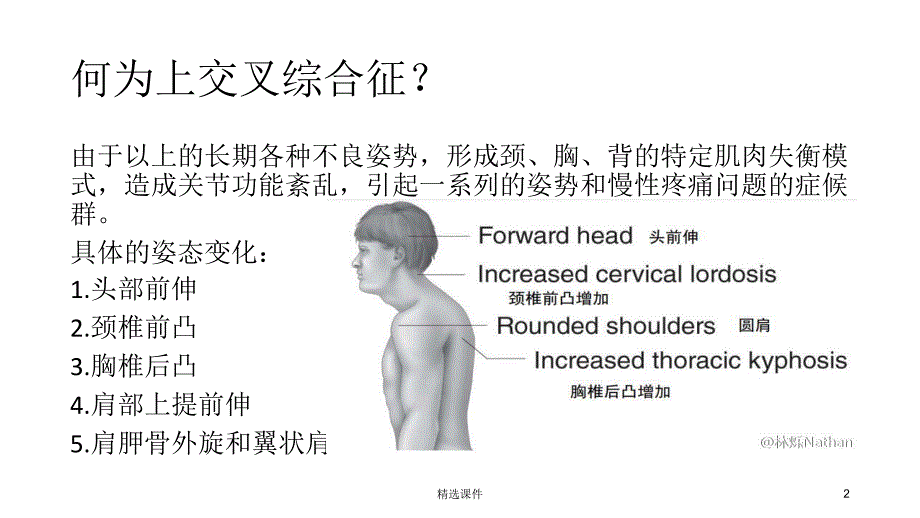 上交叉综合征的肌肉失衡及处理课件_第2页