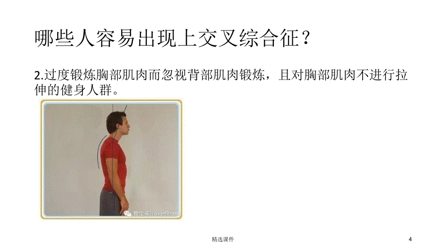 上交叉综合征的肌肉失衡及处理课件_第4页