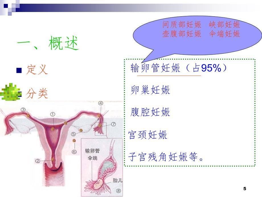 宫外孕的PPT精品文档_第5页