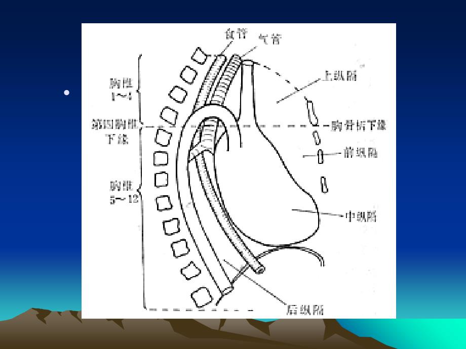 《纵隔肿瘤影像诊断》PPT课件_第3页