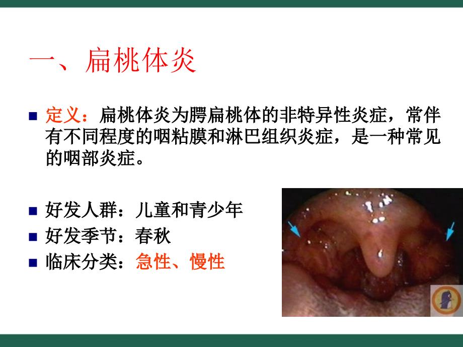 咽喉疾病的护理ppt_第2页