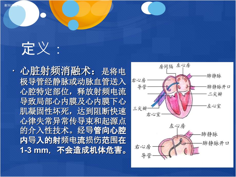 射频消融术术后护理课件_第2页