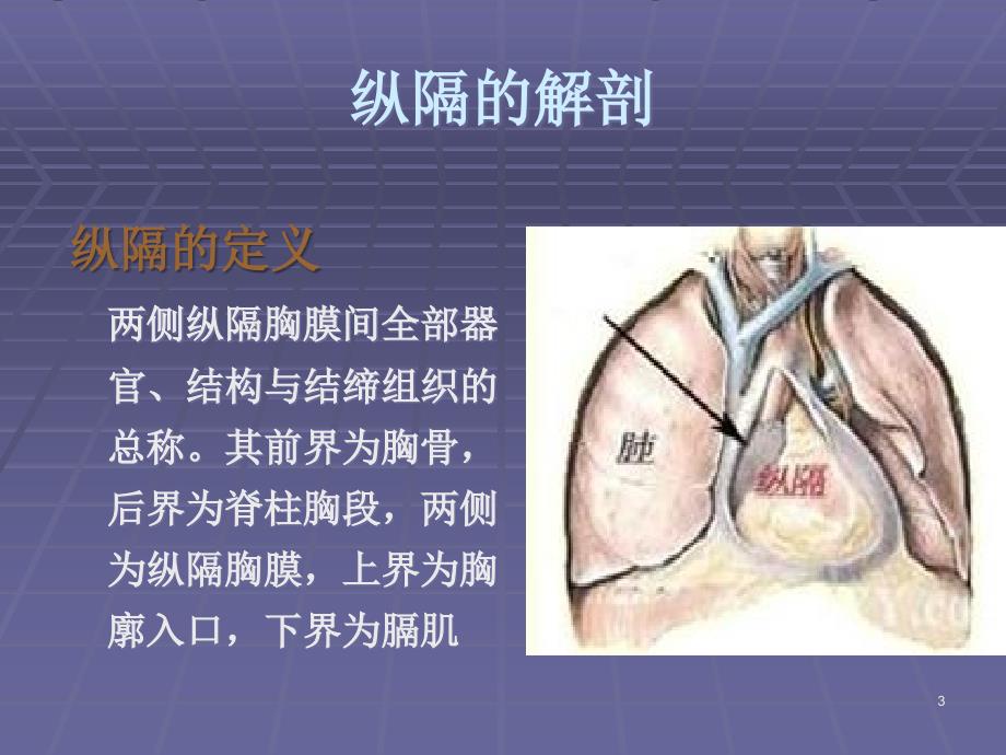 纵隔肿瘤护理常规ppt课件_第3页