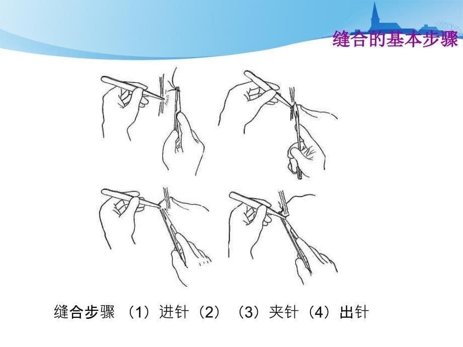 外科基本技术.ppt_第5页