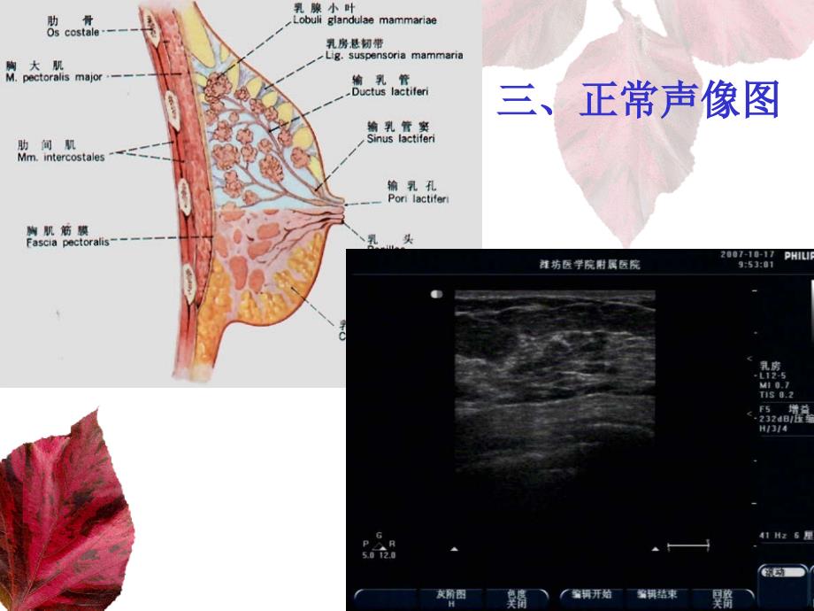 乳腺和甲状腺的超声学检查PowerPoint 演示文稿_第4页