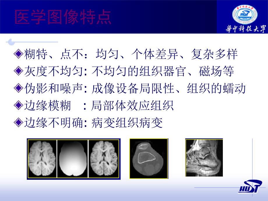 医学图像分割介绍说明课件_第4页