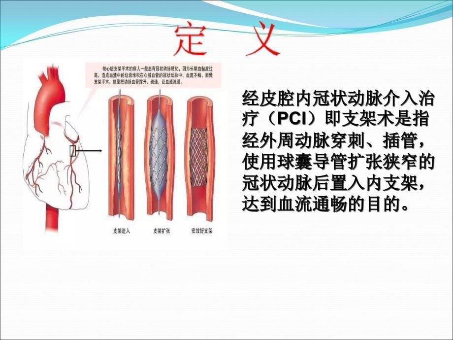 冠脉支架术后护理PPT课件02_第5页