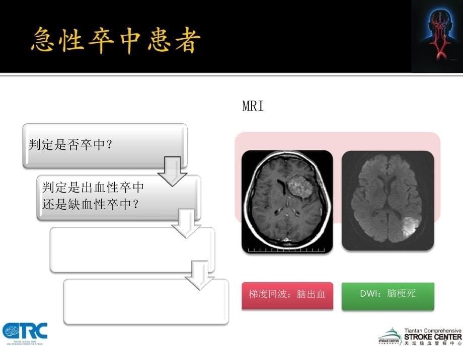 王拥军缺血性卒中诊断思路_第5页