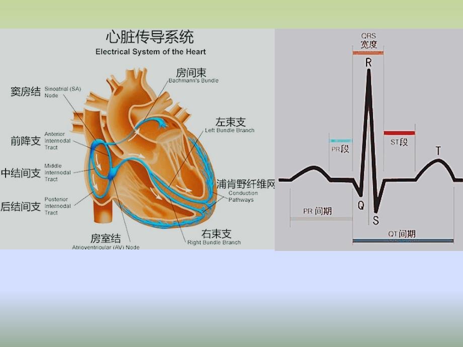 常见心电图识别_第3页