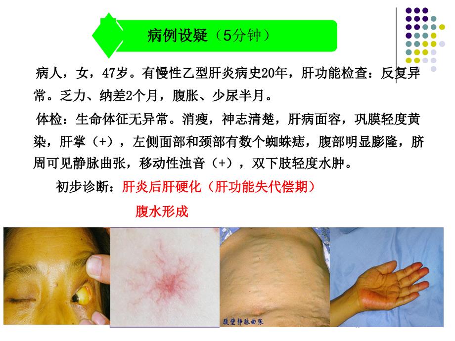 肝硬化病人额护理课件_第3页