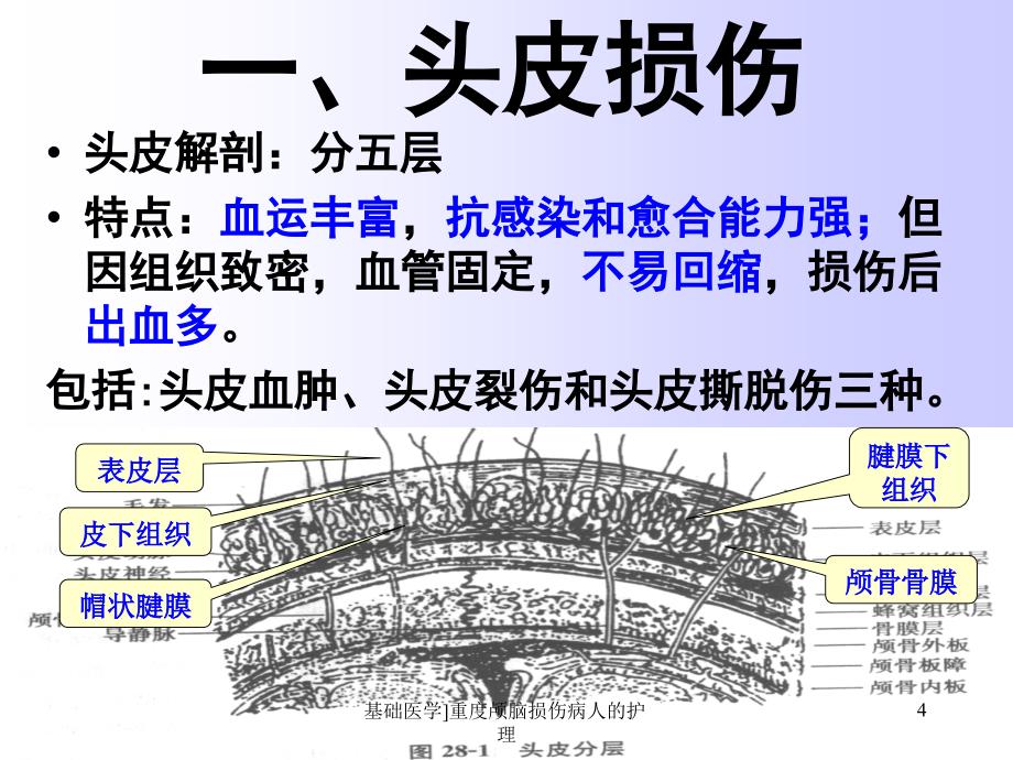 基础医学重度颅脑损伤病人的护理课件_第4页