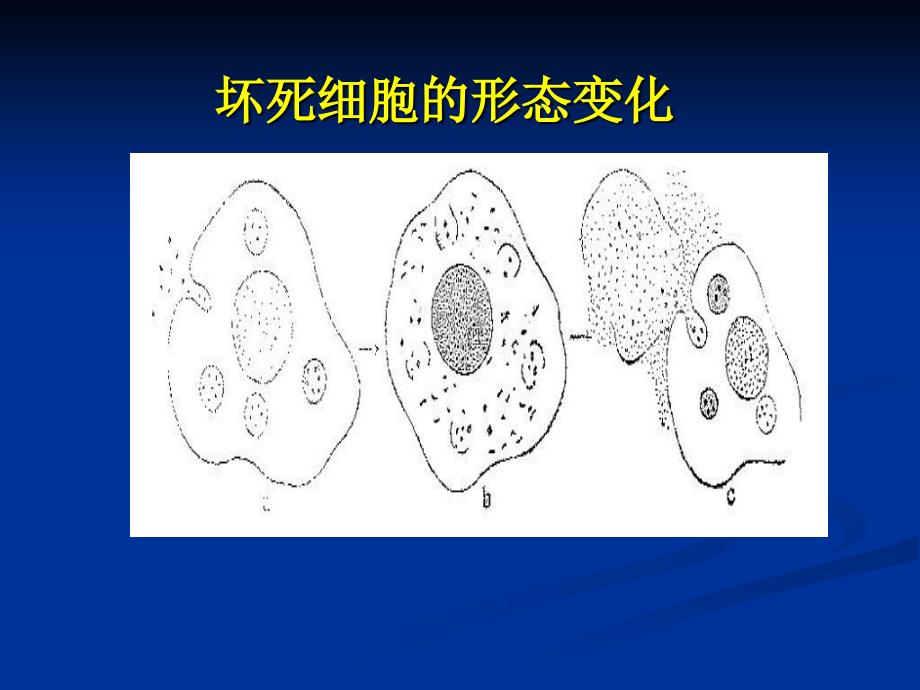 13程序性细胞死亡与细胞衰老_第4页