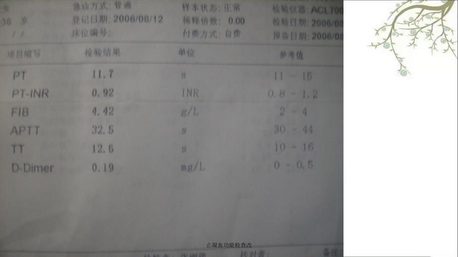 止凝血功能检查改_第1页