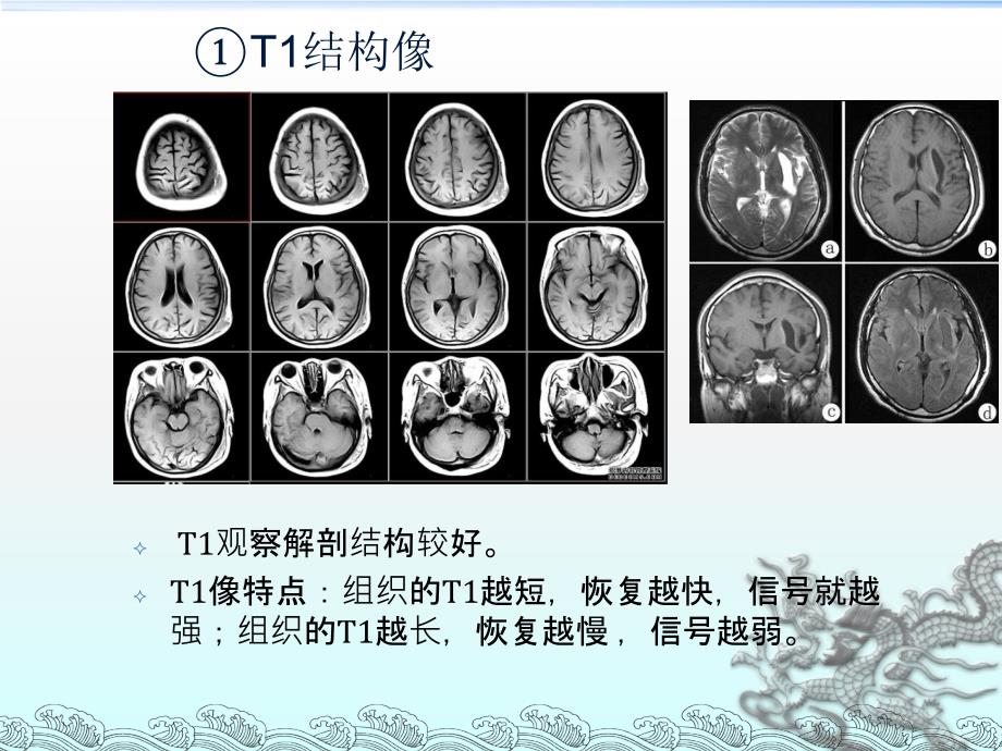 脑结构、脑功能与脑网络的可视化_第4页