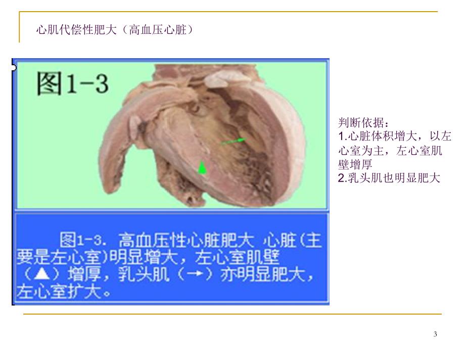 病理学大体标本ppt课件_第3页