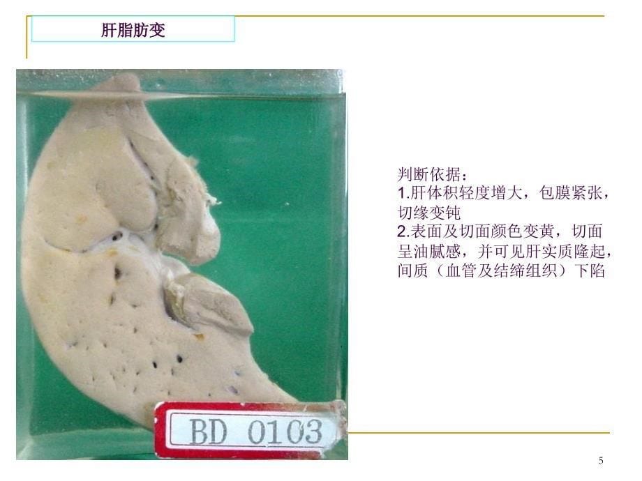 病理学大体标本ppt课件_第5页