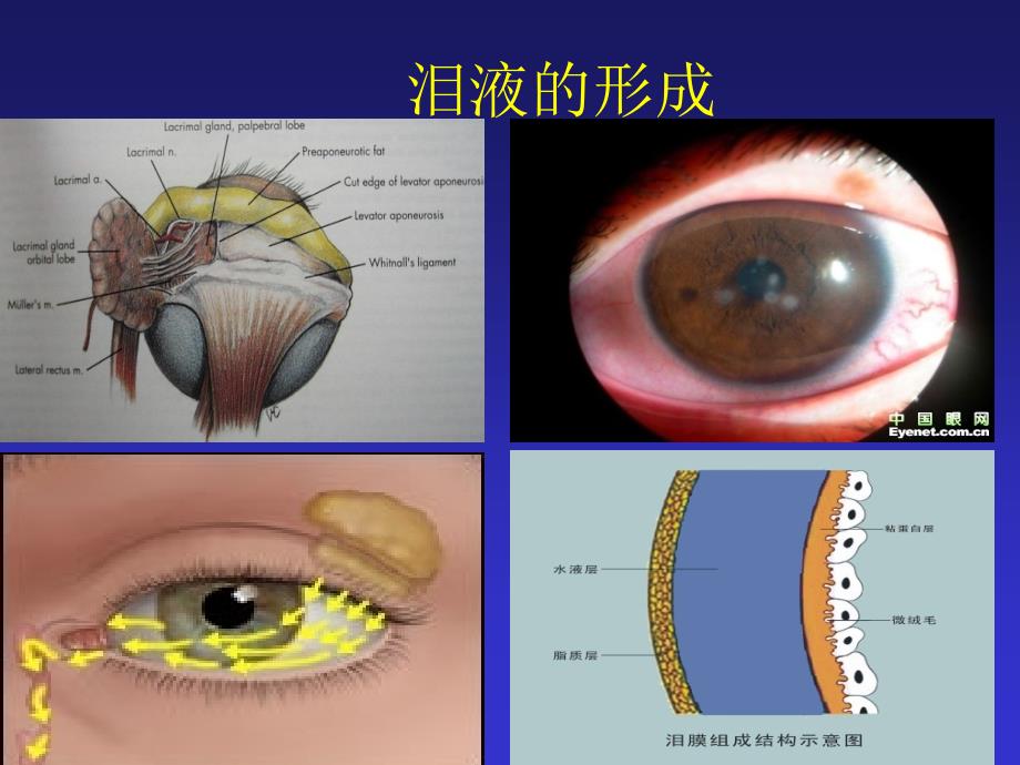 《干眼症的防治》PPT课件_第3页