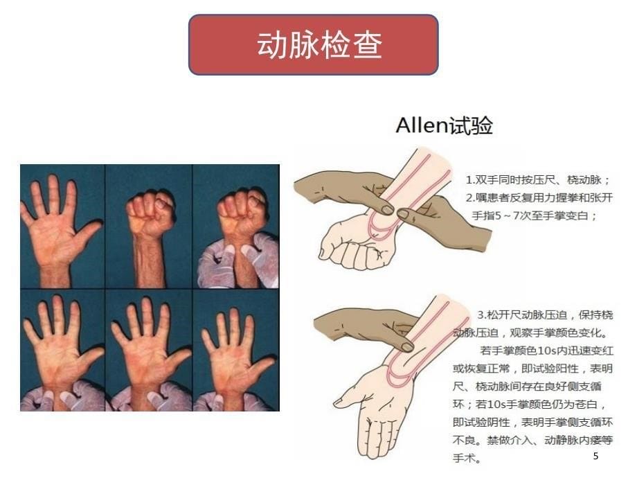 周围血管科体格检查课堂PPT_第5页