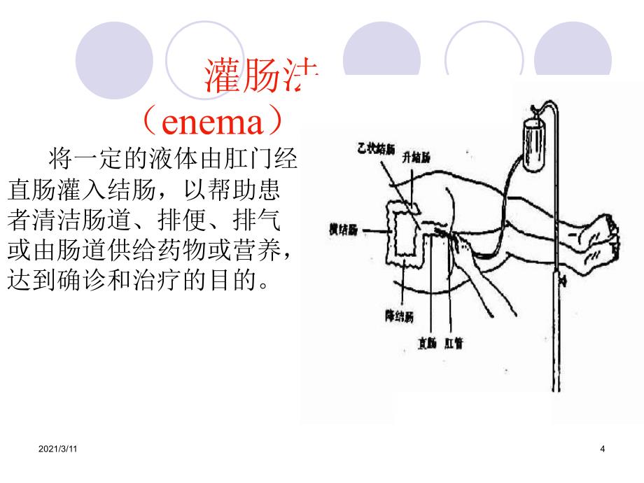 基础护理学之灌肠法PPT_第4页