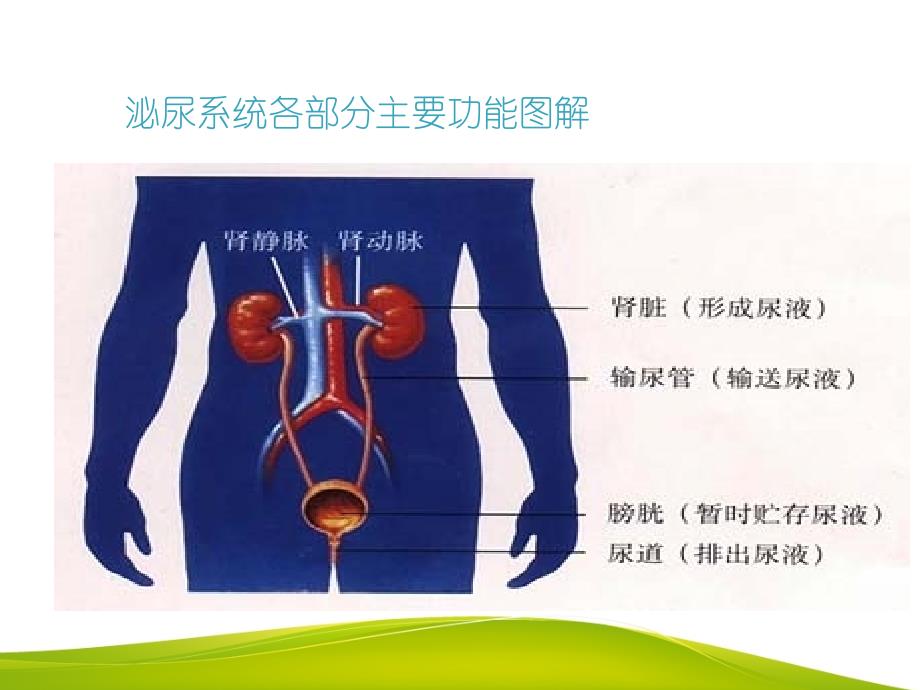 输尿管结石的护理查房_第3页