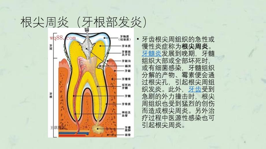 口腔常见疾病的诊治课件_第4页