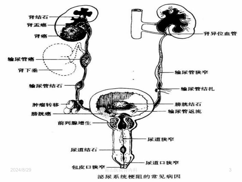 尿路感染第八版内科学文档资料_第3页