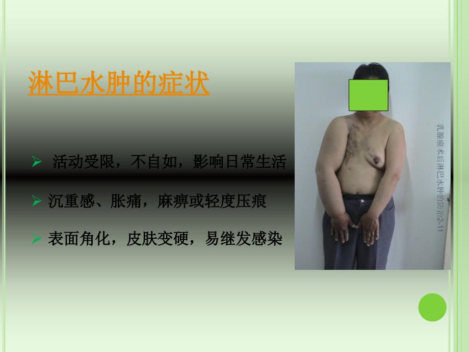 乳腺癌术后淋巴水肿的防治2-11课件_第4页