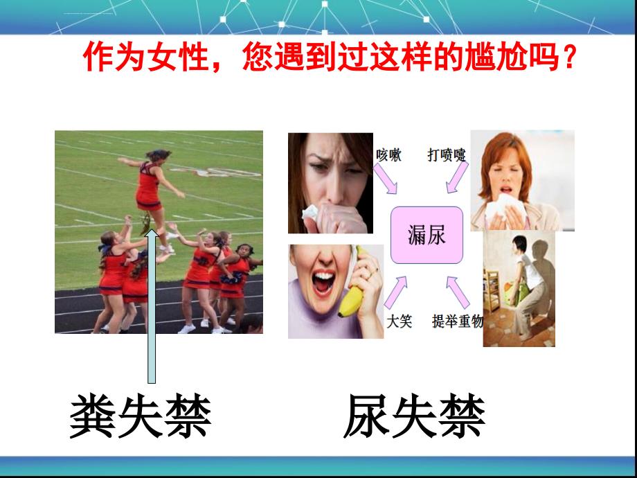 女性盆底功能障碍性疾病ppt课件_第2页