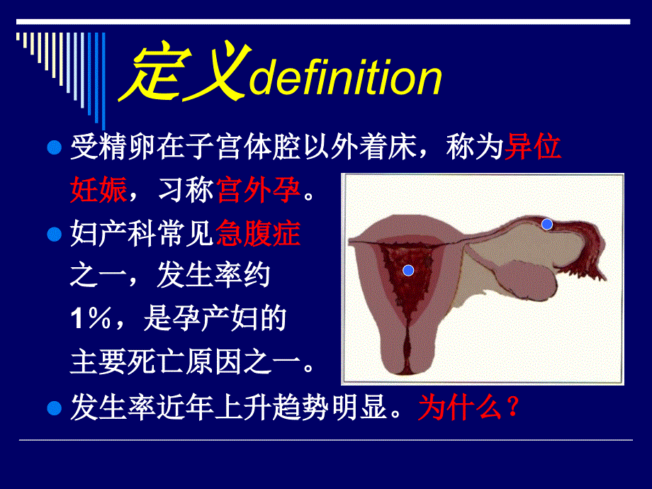 异位妊娠PPT精选文档_第3页