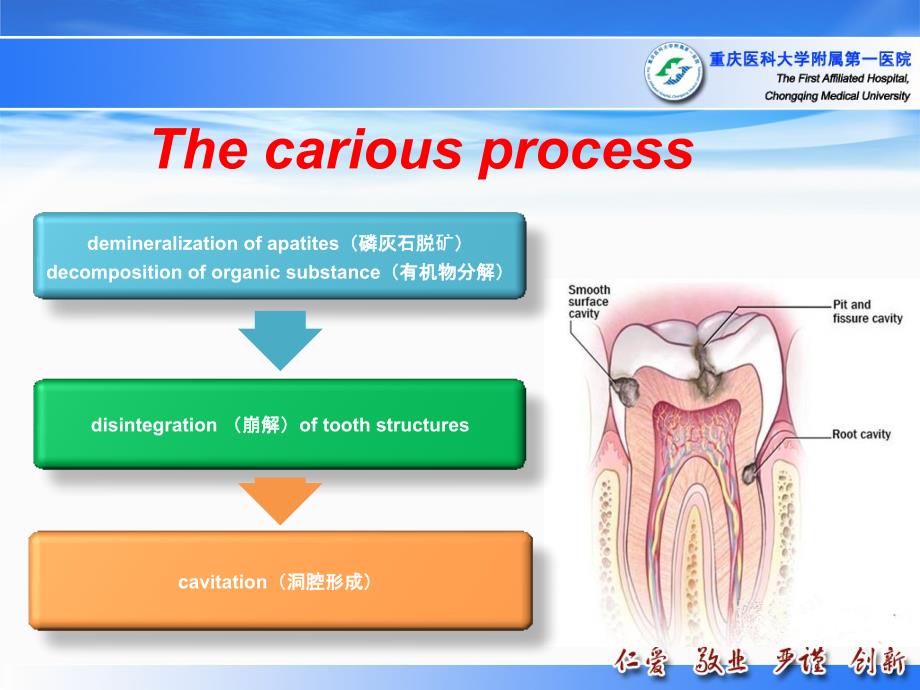 口腔科学课件：龋病_第4页