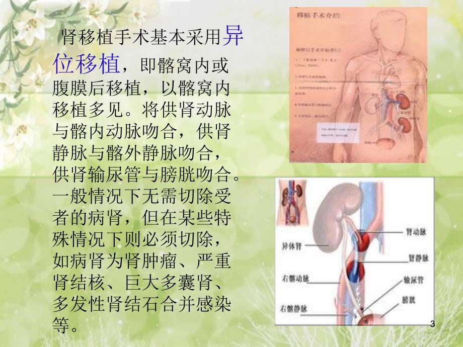 肾移植术后护理ppt课件_第3页