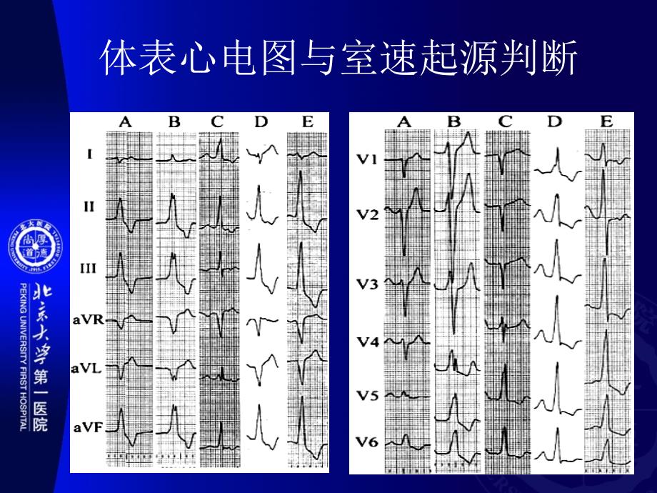 丁燕生室速起源位8_第4页