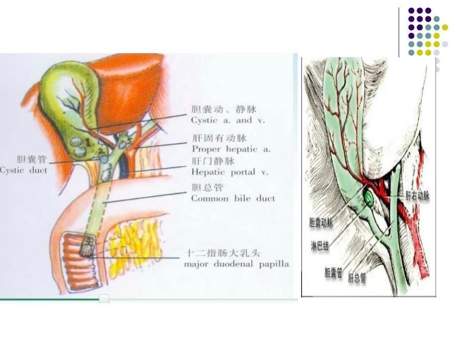 腹腔镜下保胆取石 ppt课件_第5页