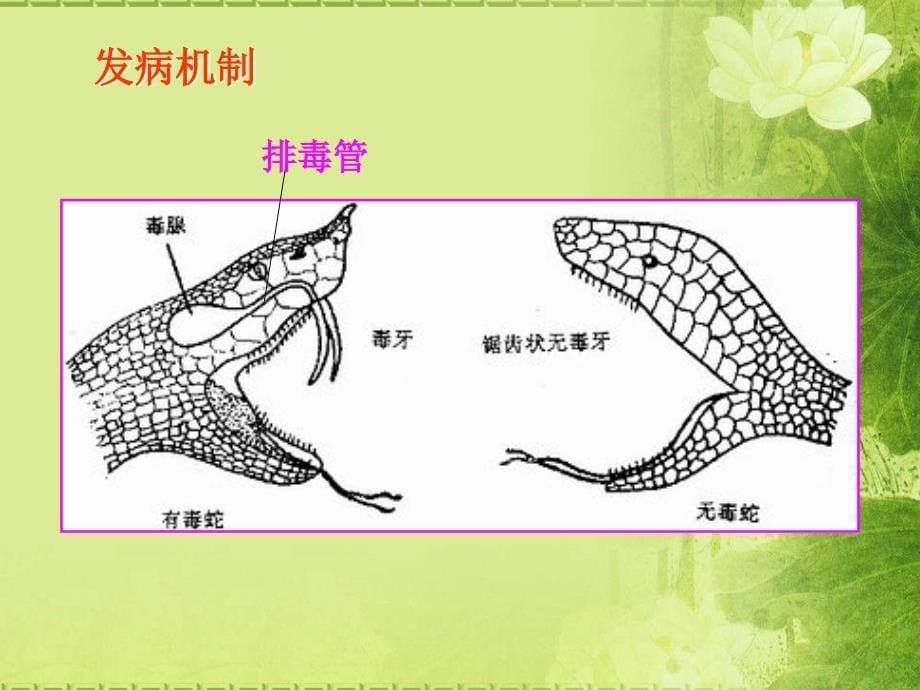 毒虫咬伤PPT课件_第5页