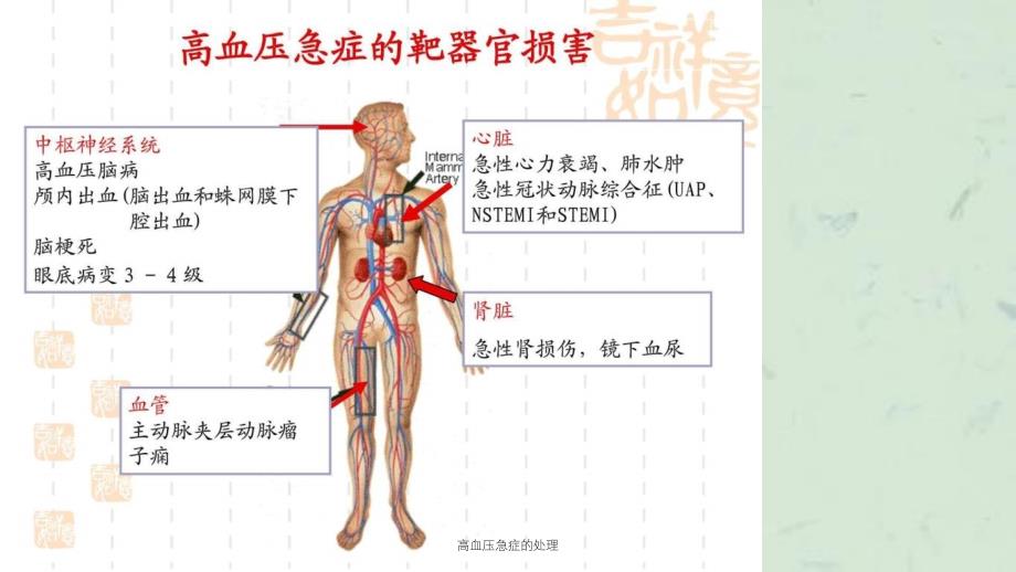 高血压急症的处理课件_第4页