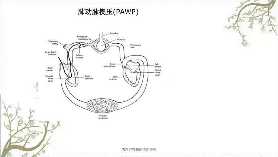 漂浮导管临床应用进展_第2页