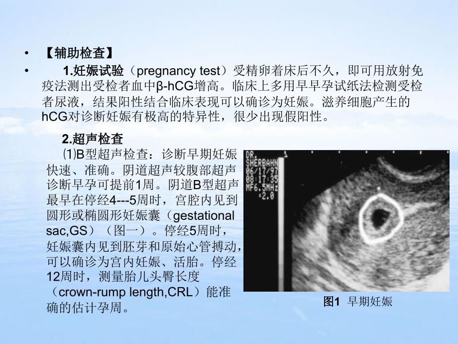 妊-娠-诊-断摘要课件_第4页