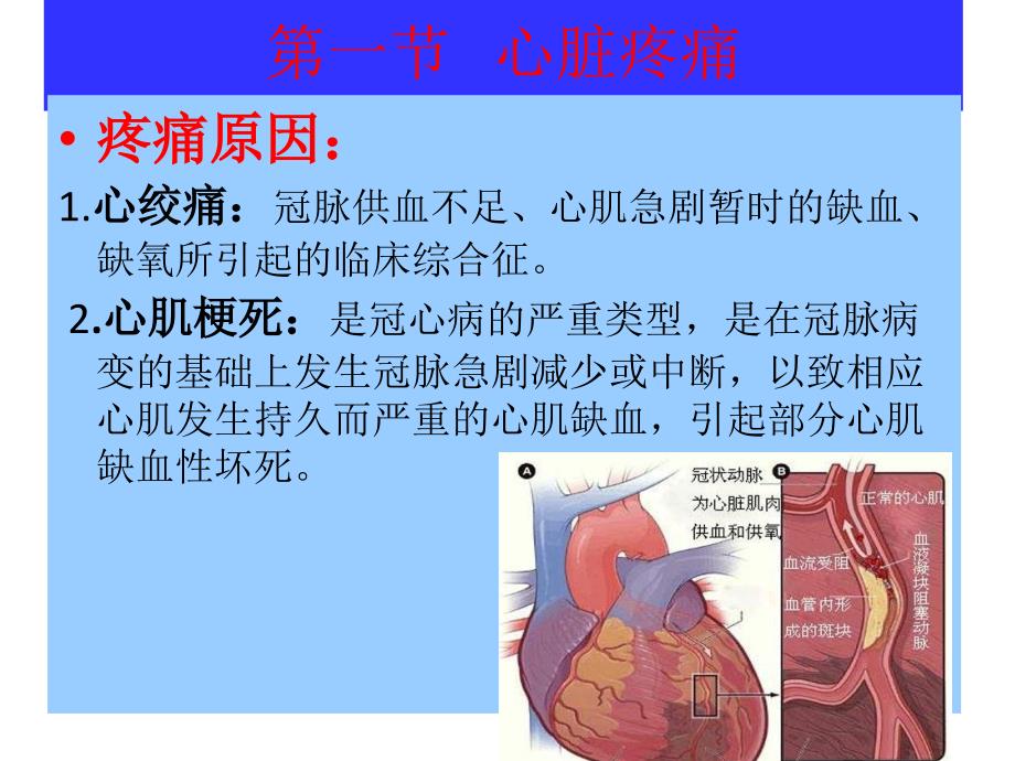 胸腹部疾病疼痛的护理课件_第3页